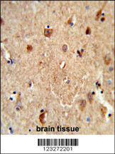 Formalin-fixed and paraffin-embedded human brain tissue reacted with CES7 Antibody (Center), which was peroxidase-conjugated to the secondary antibody, followed by DAB staining. This data demonstrates the use of this antibody for immunohistochemistry; clinical relevance has not been evaluated.