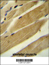 RPH3AL Antibody (C-term) (Cat. #AP10741b) immunohistochemistry analysis in formalin fixed and paraffin embedded human skeletal muscle followed by peroxidase conjugation of the secondary antibody and DAB staining. This data demonstrates the use of the RPH3AL Antibody (C-term) for immunohistochemistry. Clinical relevance has not been evaluated.