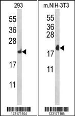 Western blot analysis of RPL18A Antibody (C-term) (Cat. #AP9141b) in Hela, 293 cell line lysates (35ug/lane). RPL18A (arrow) was detected using the purified Pab.