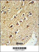 Formalin-fixed and paraffin-embedded human brain tissue reacted with RPL18A Antibody (C-term), which was peroxidase-conjugated to the secondary antibody, followed by DAB staining. This data demonstrates the use of this antibody for immunohistochemistry; clinical relevance has not been evaluated.