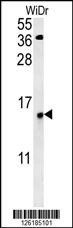 C19orf50 Antibody (Center) (Cat. #AP9140d) western blot analysis in WiDr cell line lysates (35ug/lane).This demonstrates the C19orf50 antibody detected the C19orf50 protein (arrow).