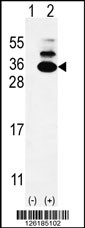 Western blot analysis of C19orf50 (arrow) using rabbit polyclonal C19orf50 Antibody (Center) (Cat. #AP9140d). 293 cell lysates (2 ug/lane) either nontransfected (Lane 1) or transiently transfected (Lane 2) with the C19orf50 gene.