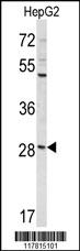 Western blot analysis of DIPA Antibody (Center) (Cat. #AP9120c) in HepG2 cell line lysates (35ug/lane). DIPA (arrow) was detected using the purified Pab.