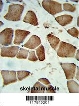 Formalin-fixed and paraffin-embedded human skeletal muscle reacted with DIPA Antibody (Center), which was peroxidase-conjugated to the secondary antibody, followed by DAB staining. This data demonstrates the use of this antibody for immunohistochemistry; clinical relevance has not been evaluated.