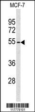 Western blot analysis of ADAMDEC1 Antibody (N-term) (Cat. #AP9119a) in MCF-7 cell line lysates (35ug/lane). ADAMDEC1 (arrow) was detected using the purified Pab.