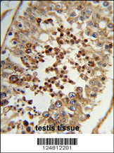 Formalin-fixed and paraffin-embedded human testis tissue reacted with TAC2N Antibody (N-term), which was peroxidase-conjugated to the secondary antibody, followed by DAB staining. This data demonstrates the use of this antibody for immunohistochemistry; clinical relevance has not been evaluated.