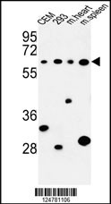Western blot analysis of PLCZ1 Antibody (N-term) (Cat. #AP9423a) in CEM, 293 cell line and mouse heart,spleen tissue lysates (35ug/lane). PLCZ1 (arrow) was detected using the purified Pab.
