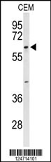 Western blot analysis of TCHP Antibody (Center) (Cat. #AP9354c) in CEM cell line lysates (35ug/lane). TCHP (arrow) was detected using the purified Pab.