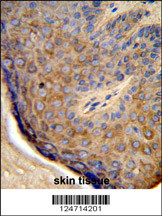 Formalin-fixed and paraffin-embedded human skin tissue reacted with TCHP Antibody (Center), which was peroxidase-conjugated to the secondary antibody, followed by DAB staining. This data demonstrates the use of this antibody for immunohistochemistry; clinical relevance has not been evaluated.