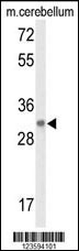 Western blot analysis of DAGLB Antibody (Center) (Cat. #AP9323c) in mouse cerebellum tissue lysates (35ug/lane). DAGLB (arrow) was detected using the purified Pab.