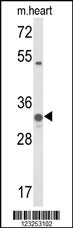 Western blot analysis of COQ5 Antibody (Center) (Cat. #AP9319c) in mouse heart tissue lysates (35ug/lane). COQ5 (arrow) was detected using the purified Pab.