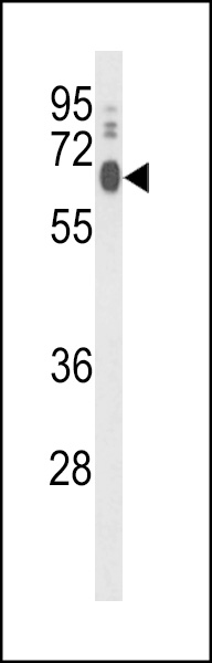 Western blot analysis of PCAT1 Antibody (C-term) (Cat.#AP9310b) in Hela cell line lysates (35ug/lane). PCAT1 (arrow) was detected using the purified Pab.