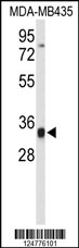 Western blot analysis of TFPT Antibody (N-term) (Cat. #RB24776) in MDA-MB435 cell line lysates (35ug/lane). TFPT (arrow) was detected using the purified Pab.