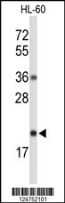 Western blot analysis of RNH2C Antibody (Center) (Cat. #AP9303c) in HL-60 cell line lysates (35ug/lane). RNH2C(arrow) was detected using the purified Pab.