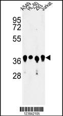 Western blot analysis of ARGLU1 Antibody (N-term) (Cat. #AP9290a) in A549, HL-60, 293, Jurkat cell line lysates (35ug/lane). ARGLU1 (arrow) was detected using the purified Pab.