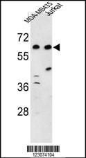 Western blot analysis of C19orf26 Antibody (Center)(Cat. #AP9274c) in MDA-MB435, Jurkat cell line lysates (35ug/lane). C19orf26 (arrow) was detected using the purified Pab.