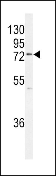 Western blot analysis of K0776 Antibody (Center) (Cat. #AP9677c) in MCF-7 cell line lysates (35ug/lane). K0776 (arrow) was detected using the purified Pab.