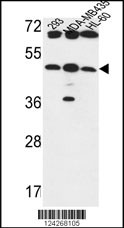 B3GNT5 Antibody (Center) (Cat. #AP9649c) western blot analysis in 293,MDA-MB435,HL-60 cell line lysates (35ug/lane).This demonstrates the B3GNT5 antibody detected the B3GNT5 protein (arrow).