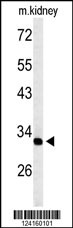 Western blot analysis of TMUB2 Antibody (Center) (Cat. #AP9642c) in mouse kidney tissue lysates (35ug/lane). TMUB2 (arrow) was detected using the purified Pab.