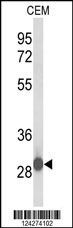 Western blot analysis of C15orf29 Antibody (N-term) (Cat. #AP9571a) in CEM cell line lysates (35ug/lane). C15orf29 (arrow) was detected using the purified Pab.