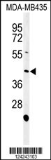 Western blot analysis of NOXA1 Antibody (C-term) (Cat. #AP9567b) in MDA-MB435 cell line lysates (35ug/lane).NOXA1 (arrow) was detected using the purified Pab.