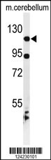 Western blot analysis of KIF6 Antibody (N-term) (Cat. #AP9564b) in mouse cerebellum tissue lysates (35ug/lane). KIF6 (arrow) was detected using the purified Pab.