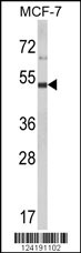 Western blot analysis of LUC7L2 Antibody (C-term) (Cat. #AP9549a) in MCF-7 cell line lysates (35ug/lane). LUC7L2 (arrow) was detected using the purified Pab.