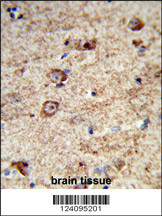 Formalin-fixed and paraffin-embedded human brain tissue reacted with LRRC4 Antibody (C-term), which was peroxidase-conjugated to the secondary antibody, followed by DAB staining. This data demonstrates the use of this antibody for immunohistochemistry; clinical relevance has not been evaluated.