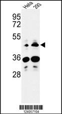 Western blot analysis of HS3ST2 Antibody (C-term) (Cat. #AP9513b) in Hela, 293 cell line lysates (35ug/lane). HS3ST2 (arrow) was detected using the purified Pab.