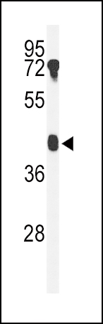 Western blot analysis of B4GALT2 Antibody (C-term) (Cat. #AP9473b) in mouse testis tissue lysates (35ug/lane). B4GALT2 (arrow) was detected using the purified Pab.