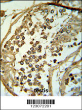 C19orf18 Antibody (Center) (Cat. #AP9826c) IHC analysis in formalin fixed and paraffin embedded testis tissue followed by peroxidase conjugation of the secondary antibody and DAB staining. This data demonstrates the use of the C19orf18 Antibody (Center) for immunohistochemistry. Clinical relevance has not been evaluated.