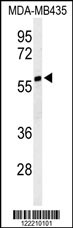 Western blot analysis of NARFL Antibody (Center) (Cat. #AP9824c) in MDA-MB435 cell line lysates (35ug/lane). NARFL (arrow) was detected using the purified Pab.