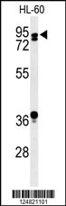 Western blot analysis of PATL1 Antibody (C-term) (Cat. #AP9796b) in HL-60 cell line lysates (35ug/lane). PATL1 (arrow) was detected using the purified Pab.
