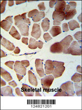 PATL1 Antibody (C-term) (Cat. #AP9796b) IHC analysis in formalin fixed and paraffin embedded skeletal muscle followed by peroxidase conjugation of the secondary antibody and DAB staining. This data demonstrates the use of the PATL1 Antibody (C-term) for immunohistochemistry. Clinical relevance has not been evaluated.