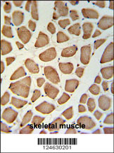 GPSN2 Antibody (C-term) (Cat. #AP9788b) IHC analysis in formalin fixed and paraffin embedded skeletal muscle followed by peroxidase conjugation of the secondary antibody and DAB staining. This data demonstrates the use of the GPSN2 Antibody (C-term) for immunohis??