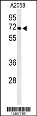 Western blot analysis of ATP6V1A Antibody (Center) (Cat. #AP9778b) in A2058 cell line lysates (35ug/lane). ATP6V1A (arrow) was detected using the purified Pab.