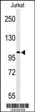 Western blot analysis of PKHH2 Antibody (C-term) (Cat. #AP9773b) in Jurkat cell line lysates (35ug/lane). PKHH2 (arrow) was detected using the purified Pab.