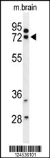 Western blot analysis of HSPA12A Antibody (Center) (Cat. #AP9765c) in mouse brain tissue lysates (35ug/lane). HSPA12A (arrow) was detected using the purified Pab.
