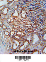 MOSC1 Antibody (Center) (Cat. #AP9754c) immunohistochemistry analysis in formalin fixed and paraffin embedded human kidney tissue followed by peroxidase conjugation of the secondary antibody and DAB staining. This data demonstrates the use of the MOSC1 Antibody (Center) for immunohistochemistry. Clinical relevance has not been evaluated.