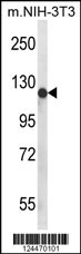 Western blot analysis of PIGN Antibody (N-term) (Cat. #AP9751a) in mouse NIH-3T3 cell line lysates (35ug/lane). PIGN (arrow) was detected using the purified Pab.