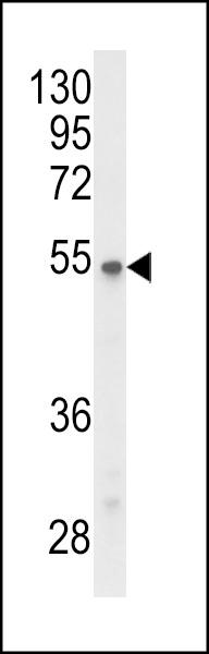 Western blot analysis of P2R3C Antibody (N-term) (Cat. #AP9743a) in Y79 cell line lysates (35ug/lane). P2R3C (arrow) was detected using the purified Pab.