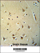 P2R3C Antibody (N-term) (Cat. #AP9743a) immunohistochemistry analysis in formalin fixed and paraffin embedded human brain tissue followed by peroxidase conjugation of the secondary antibody and DAB staining. This data demonstrates the use of the P2R3C Antibody (N-term) for immunohistochemistry. Clinical relevance has not been evaluated.