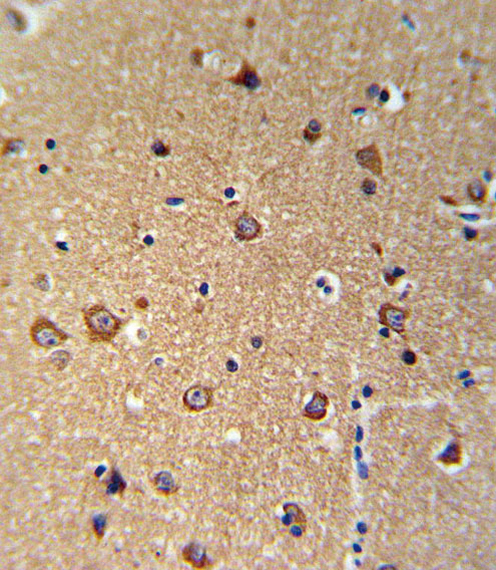 ANKH Antibody (C-term) (Cat. #AP9741b) IHC analysis in formalin fixed and paraffin embedded brain tissue followed by peroxidase conjugation of the secondary antibody and DAB staining. This data demonstrates the use of the ANKH Antibody (C-term) for immunohistochemistry. Clinical relevance has not been evaluated.