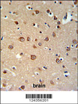 PDE6C Antibody (Center) (Cat. #AP9728c) IHC analysis in formalin fixed and paraffin embedded brain tissue followed by peroxidase conjugation of the secondary antibody and DAB staining. This data demonstrates the use of the PDE6C Antibody (Center) for immunohistochemistry. Clinical relevance has not been evaluated.