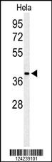 Western blot analysis of ADPRHL2 Antibody (N-term) (Cat. #AP9723a) in Hela cell line lysates (35ug/lane). ADPRHL2 (arrow) was detected using the purified Pab.