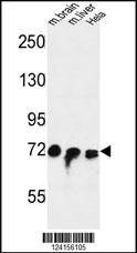 FAM40A Antibody (Center) (Cat. #AP9717c) western blot analysis in mouse brain,liver tissue and Hela cell line lysates (35ug/lane).This demonstrates the FAM40A antibody detected the FAM40A protein (arrow).