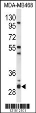Western blot analysis of PSMG2 Antibody (C-term) (Cat. #AP9698b) in MDA-MB468 cell line lysates (35ug/lane). PSMG2 (arrow) was detected using the purified Pab.