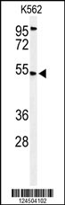 Western blot analysis of CBAA1 Antibody (N-term) (Cat. #AP9682a) in K562 cell line lysates (35ug/lane). CBAA1 (arrow) was detected using the purified Pab.