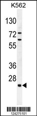 C15orf41 Antibody (Center) (Cat. #AP10700c) western blot analysis in K562 cell line lysates (35ug/lane).This demonstrates the C15orf41 antibody detected the C15orf41 protein (arrow).