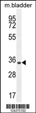 C15orf41 Antibody (Center) (Cat. #AP10700c) western blot analysis in mouse bladder tissue lysates (35ug/lane).This demonstrates the C15orf41 antibody detected the C15orf41 protein (arrow).